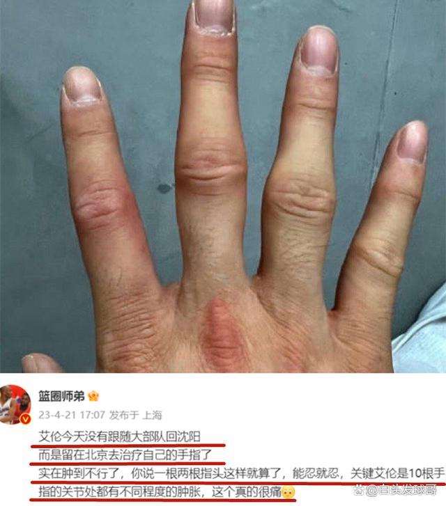 包含澳大利亚联赛新赛季主力球员出现意外伤情的词条